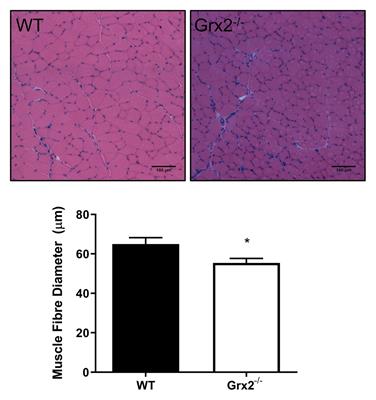 Grx2 Regulates Skeletal Muscle Mitochondrial Structure and Autophagy